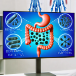 Dysbacteriosis